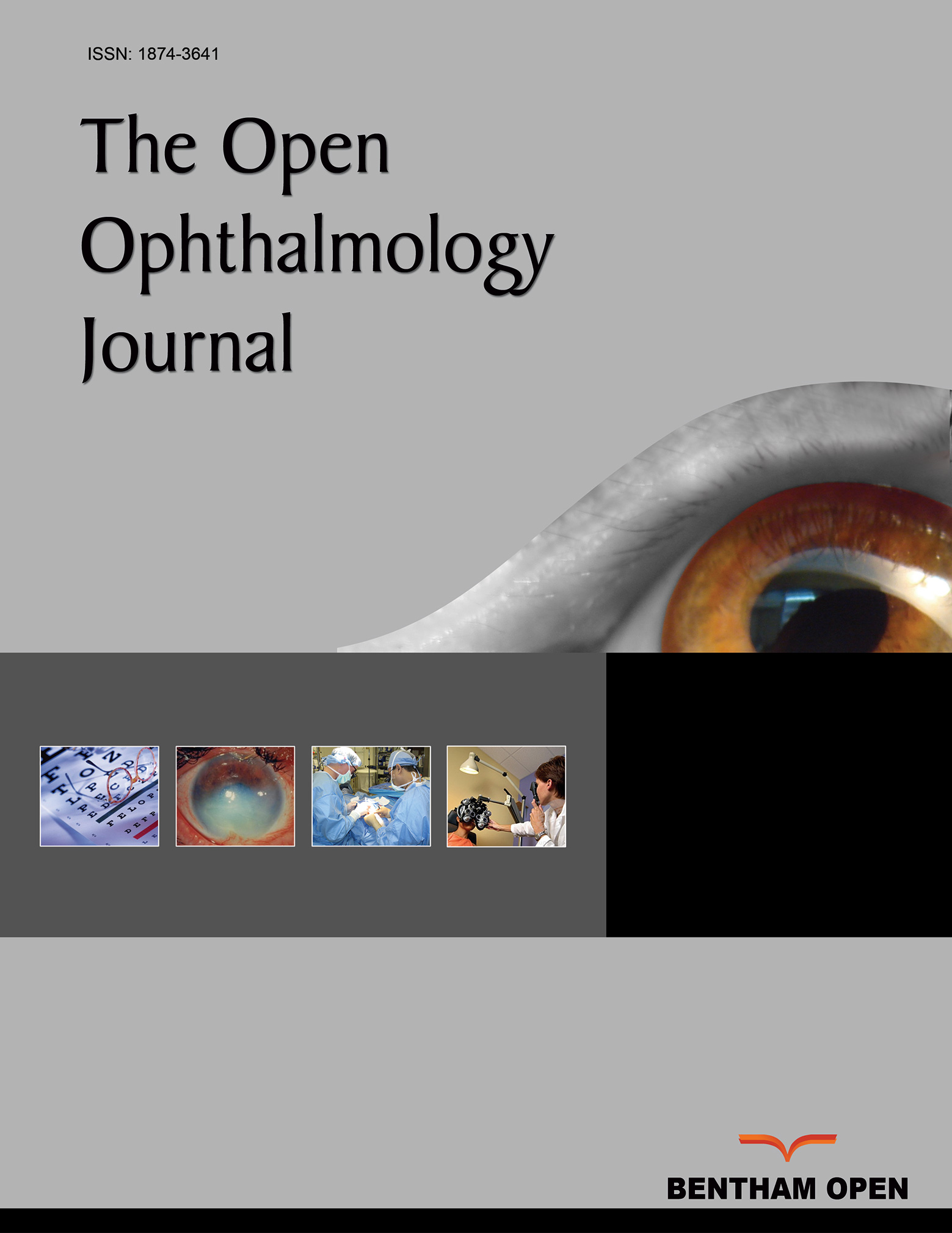 The Open Ophthalmology Journal